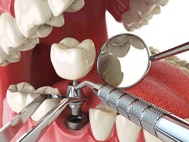 Best Emergency Dental Care for Broken or Chipped Teeth in Pembroke, GA